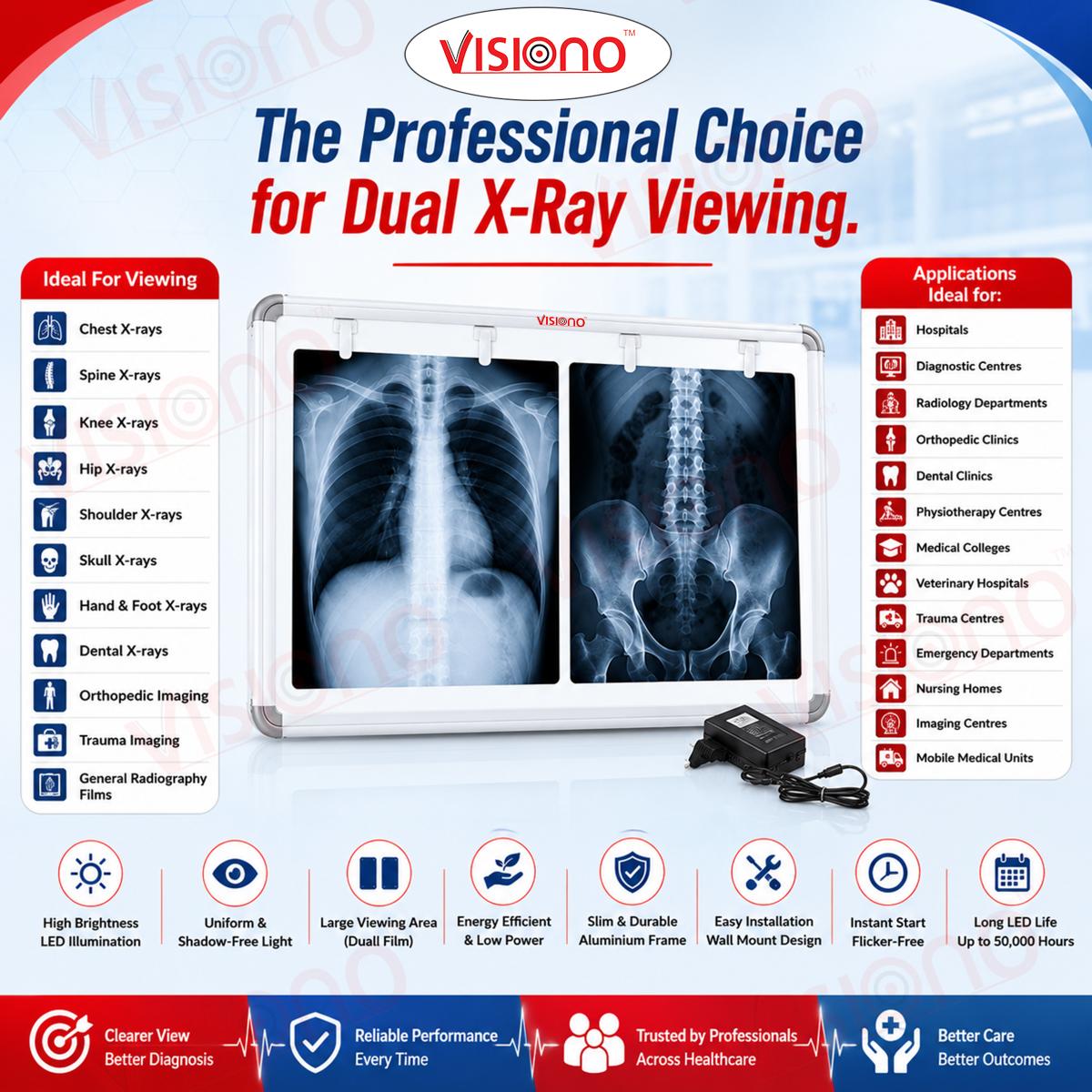 DOUBLE X RAY VIEW ILLUMINATOR 17''X29''