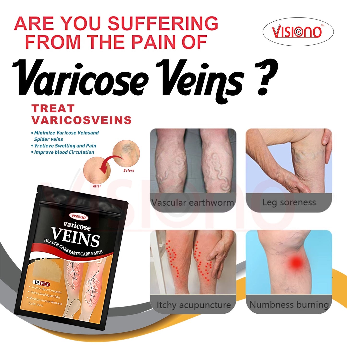 Varicose Veins Herbal Patch