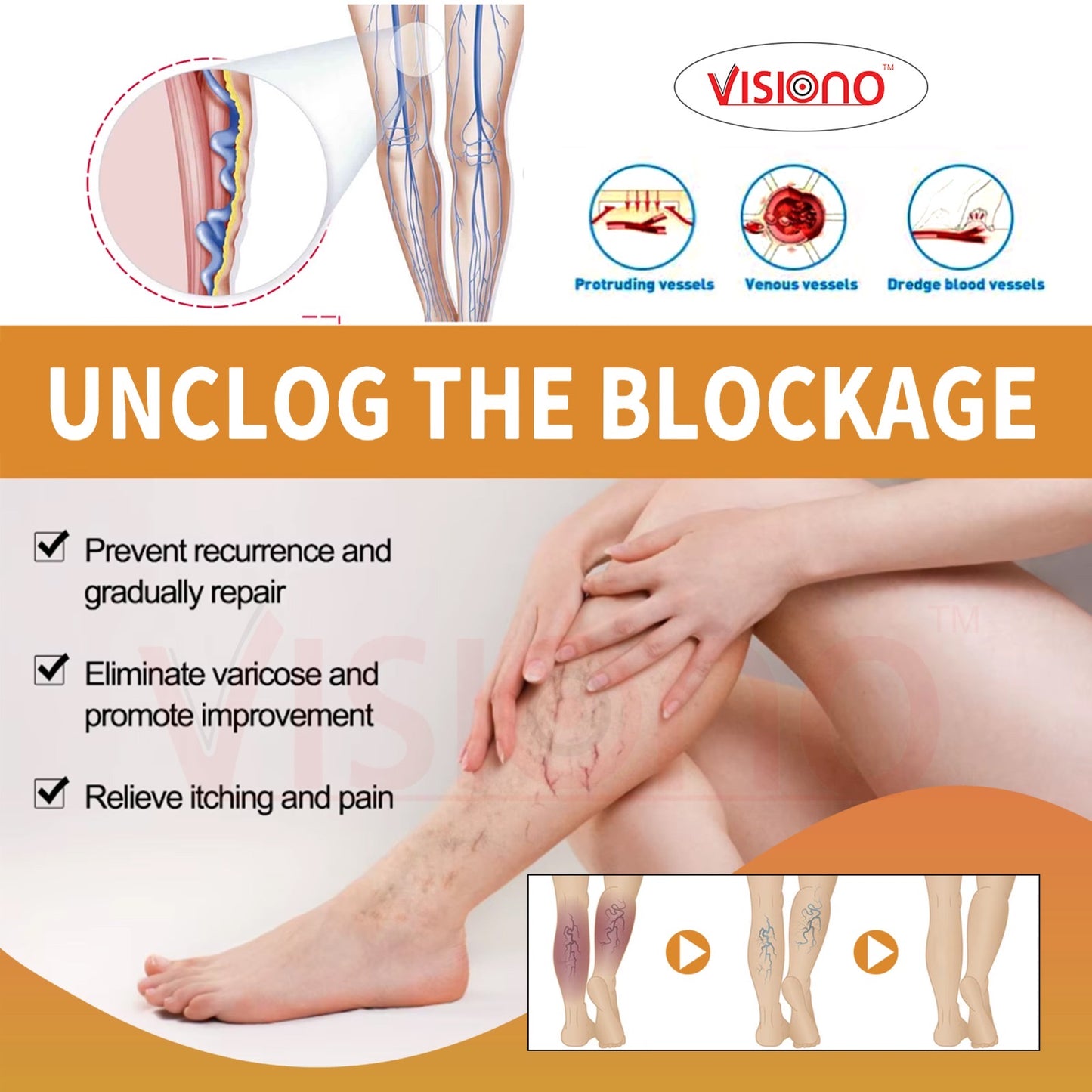 Varicose Veins Herbal Patch