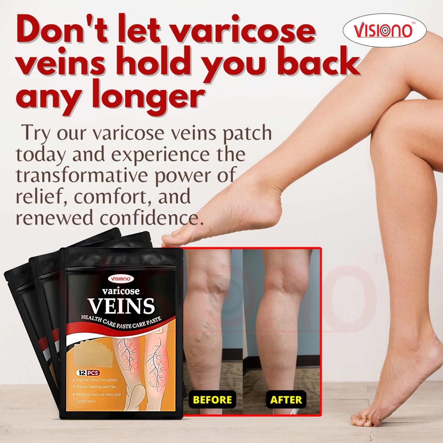 Varicose Veins Herbal Patch