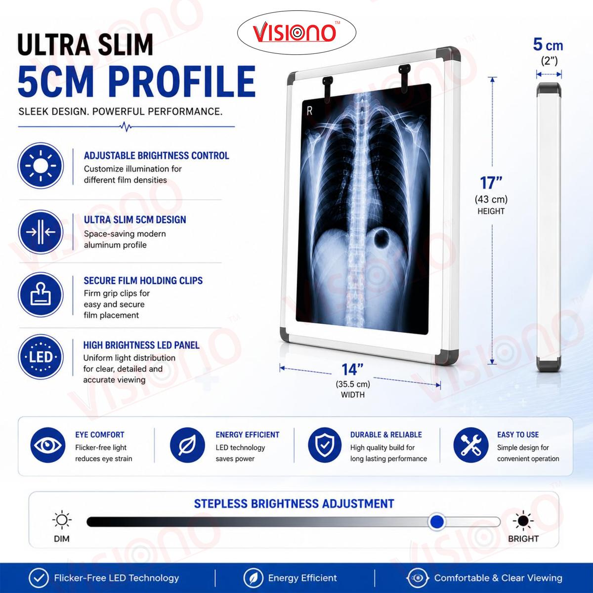 X RAY VIEW ILLUMINATOR SINGLE