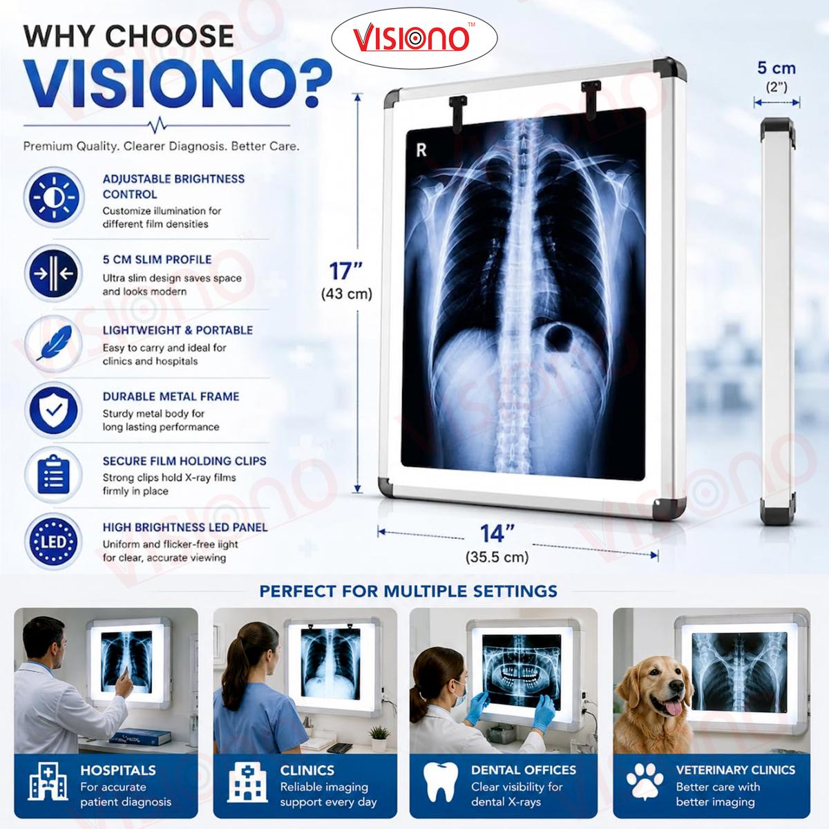 X RAY VIEW ILLUMINATOR SINGLE