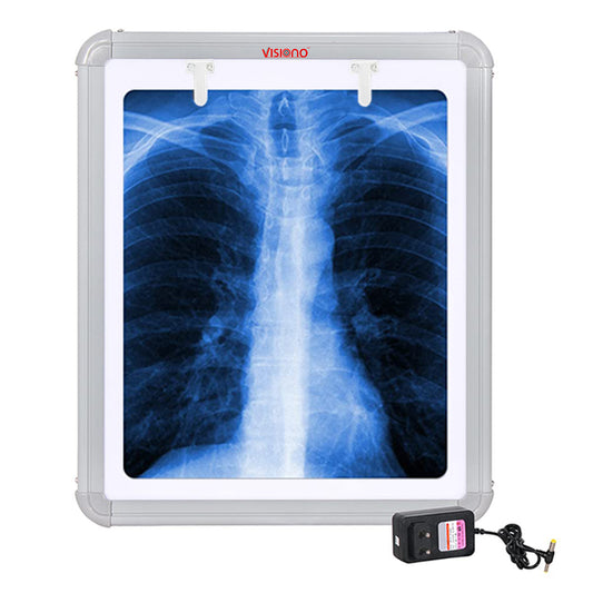 X RAY VIEW ILLUMINATOR SINGLE